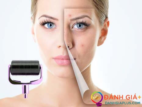 Cách chăm sóc da mặt sau khi lăn kim an toàn và hiệu quả nhất